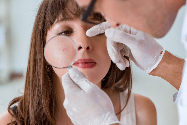 See a Board-Certified Dermatologist | How to Deal With Acne Problems At 30