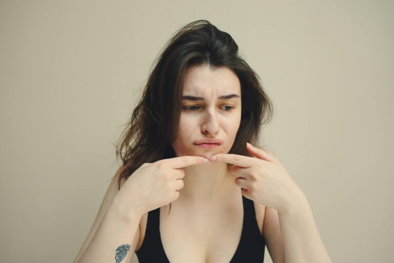Do Hydrocolloid Patches Work For Acne?